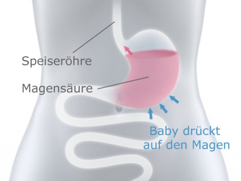 Sodbrennen in der Schwangerschaft - Mamiweb.de