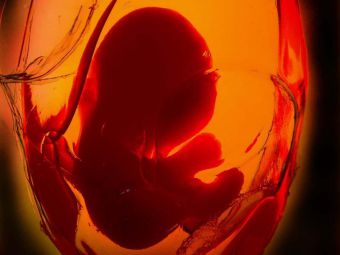 Baby´s Entwicklung soll ungestört sein