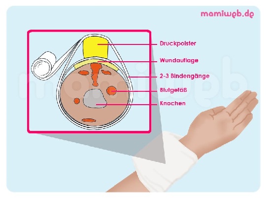 Druckverband: Erste Hilfe Bei Starker Blutung - Mamiweb.de