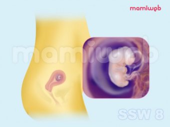 8. Schwangerschaftswoche (8. SSW)